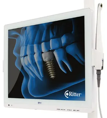 Picture of Intraoral Camera - Monitor and Mount Included